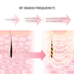 纖體去紋按摩儀 rf body massager