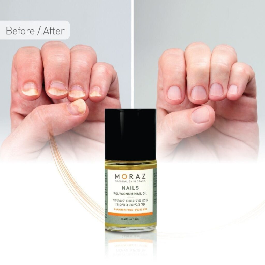nail3