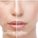 冷暖導入儀 hot/cool skin device